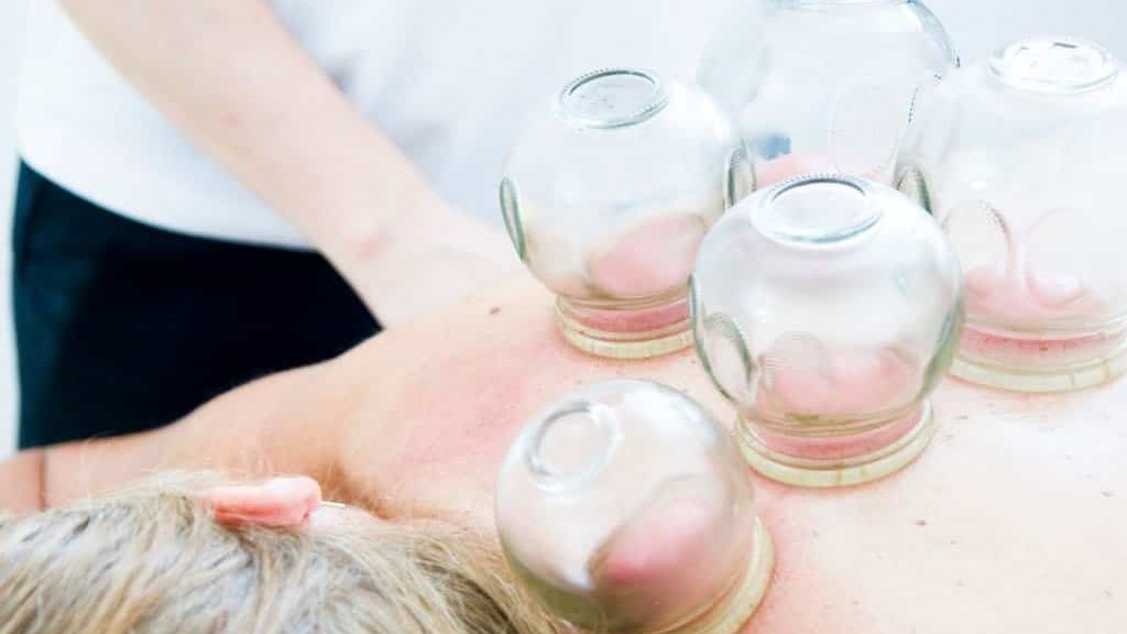 massage with five decompression jars on the back 