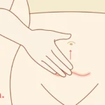 Massage C Section Scarring