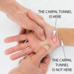How to Massage Carpal Tunnel for Relief: A Step-by-Step Guide to Massage Therapy for Carpal Tunnel Syndrome