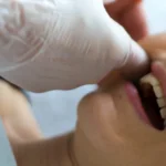 Jaw Tension Jaw massage