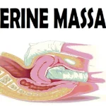 Fundal Massage