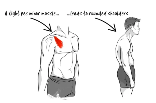 How to Massage Shoulder Blade
