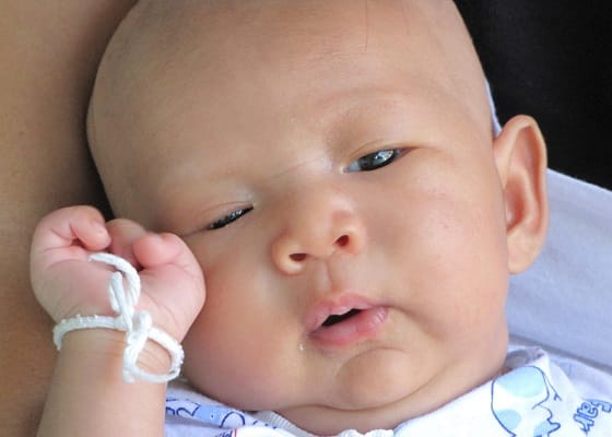 How to Massage a Blocked Tear Duct in Babies How to Massage a Blocked Tear Duct in Babies