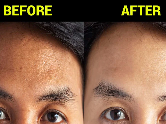 Benefits Of Massaging Forehead