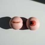 massage breast scar