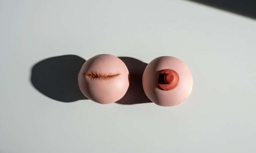 How Do You Massage Breast Scar Tissue to Break It Down? Expert Tips