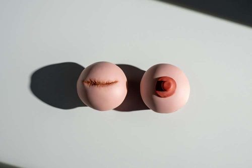 massage breast scar
