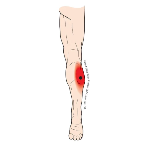 How To Identify Knots In Your Calves