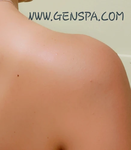 How To Massage A Pinched Nerve In The Neck