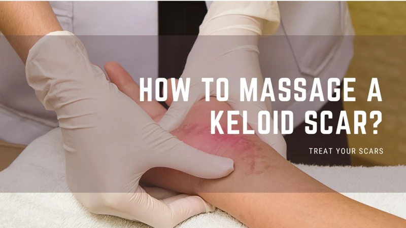 How To Massage Keloid Scars?