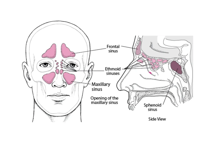 How To Massage Mucus Out Of Sinuses
