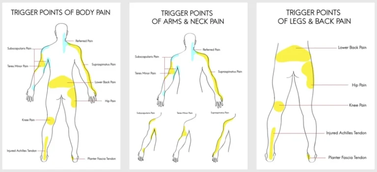How To Massage Trigger Points In Back