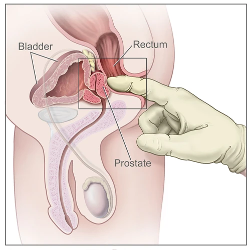 Safety And Precautions For External Prostate Massage