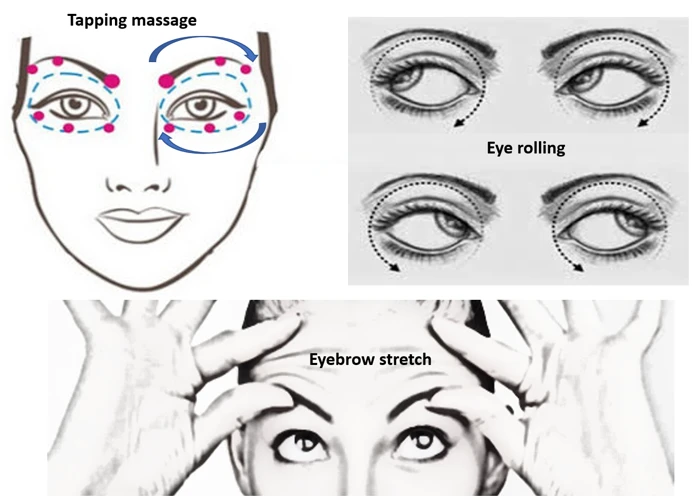 Understanding The Causes Of Under Eye Bags