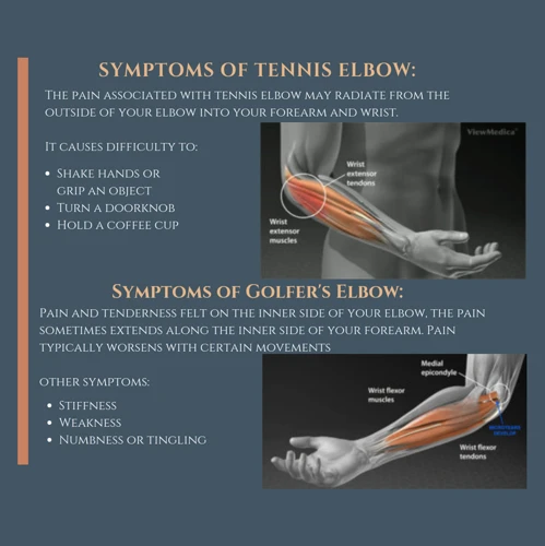 What Causes Tennis Elbow?