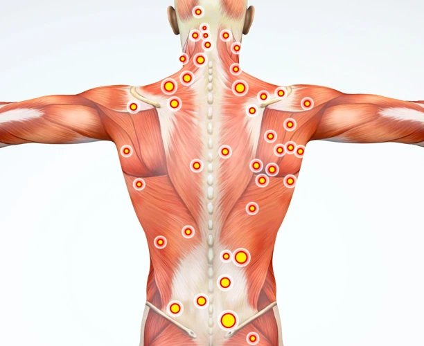 What Is Muscle Cramping?