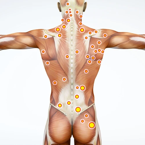 What Is Trigger Point Therapy Massage?