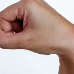 Massage to Ease the Pain of a Ganglion Cyst