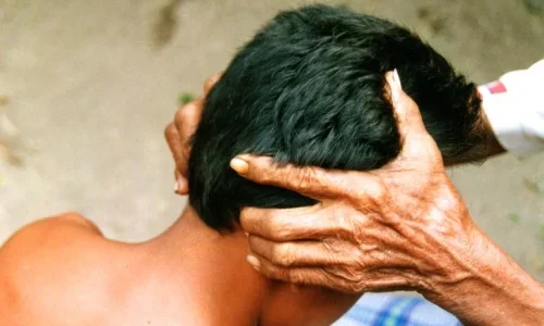 How to Massage the Back of Your Head for Maximum Relaxation