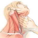 How to Perform Carotid Massage