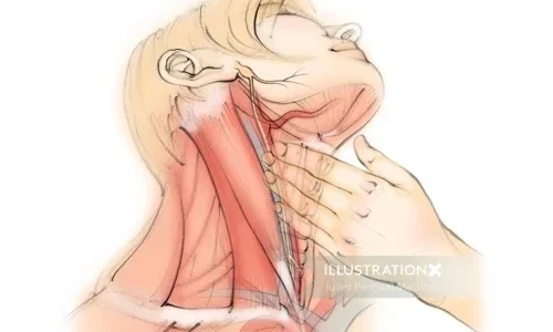 Carotid Sinus Massage: A Simple Touch with a Powerful Effect on Heart Health