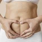 C-Section Scar Massage