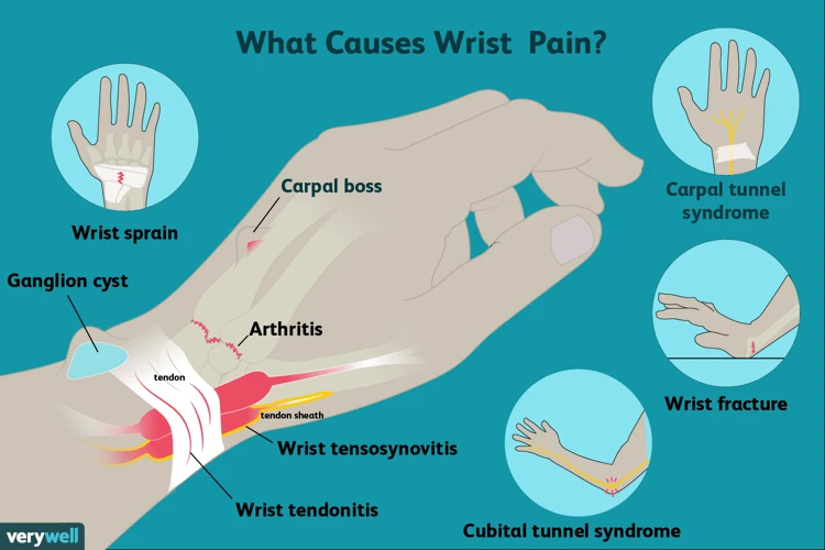Causes And Risk Factors Of Wrist Tendonitis
