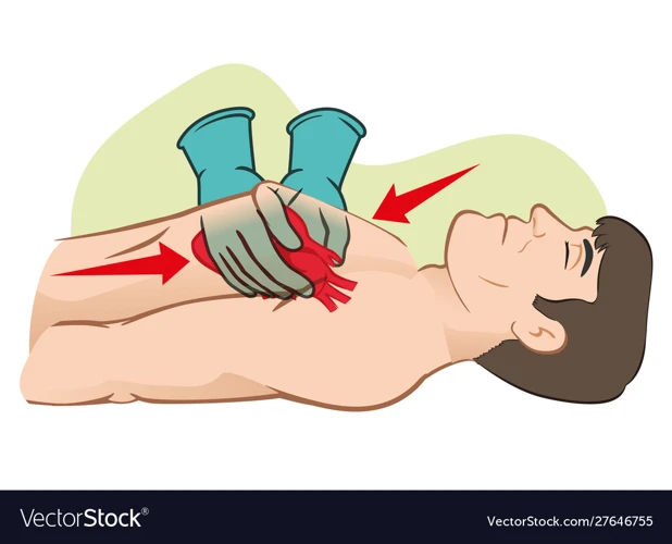 How To Perform External Cardiac Massage
