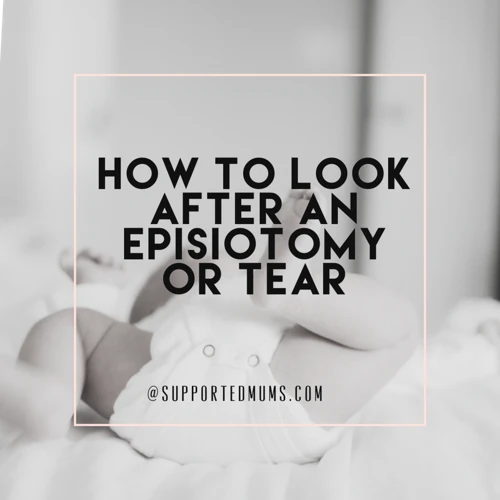 Massaging Episiotomy Scar Tissue