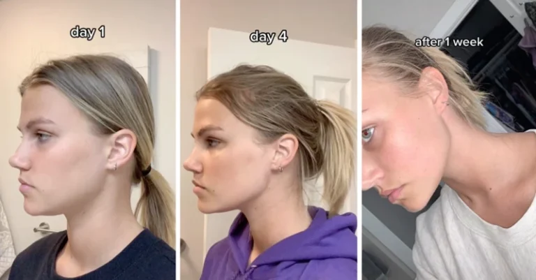 Precautions To Consider When Massaging Jawline