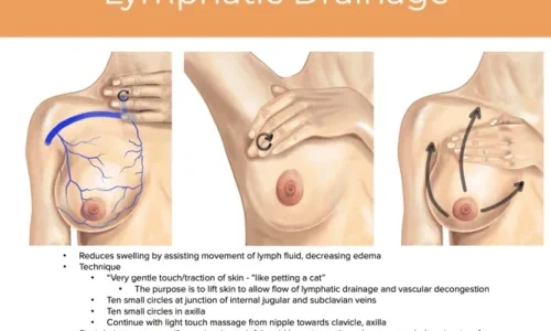 How to Massage Swollen Breasts: A Step-by-Step Guide to Soothe Soreness and Reduce Swelling