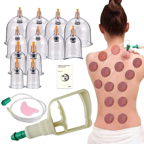 Where To Buy Massage Cups