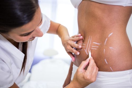 How to Self-Massage After Lipo 360