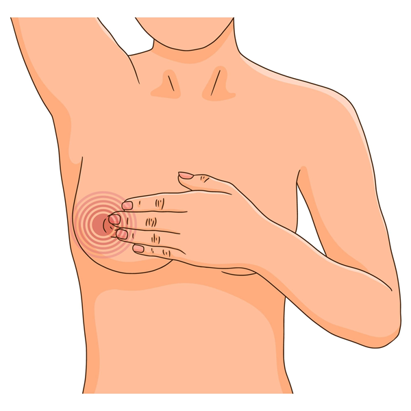 Lifestyle Tips to Reduce Breast Swelling