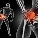 massage-for-sciatica