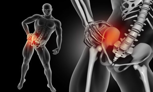 Massage for Sciatica: How to Relieve Sciatic Nerve Pain Safely