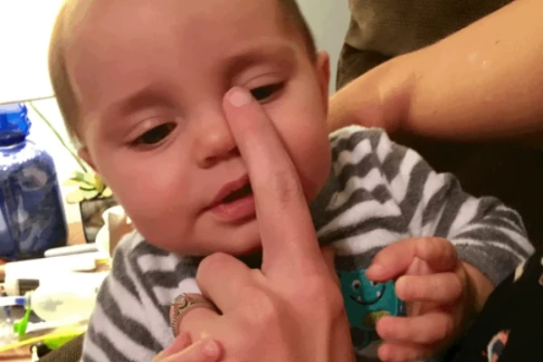 A parent’s fingertip placed on the inner corner of a baby’s eye beside the bridge of the nose