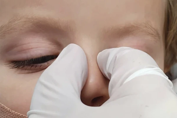 Fingertips resting at the inner corners of a sleeping baby’s eyes, against the sides of the nose